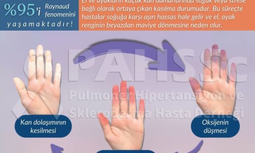 Ekim Ayı Raynaud Farkındalık Ayı - 2020.10.01