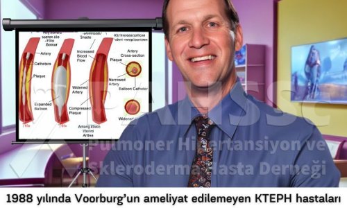 KTEPH'in Tarihçesi -7- Voorburg Önerdi, Feinstein Doğruladı - Cerrahi Tedavi Seçeneği Olmayan KTEPH Hastalarına Balon Pulmoner Anjiyoplasti (BPA) Çözümü - 2024.07.18