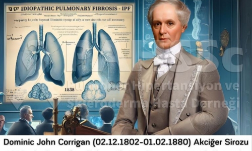 İPF'nin Tarihçesi -2- Dominic John Corrigan (1802-1880) - Akciğer Sirozu - 2024.07.12