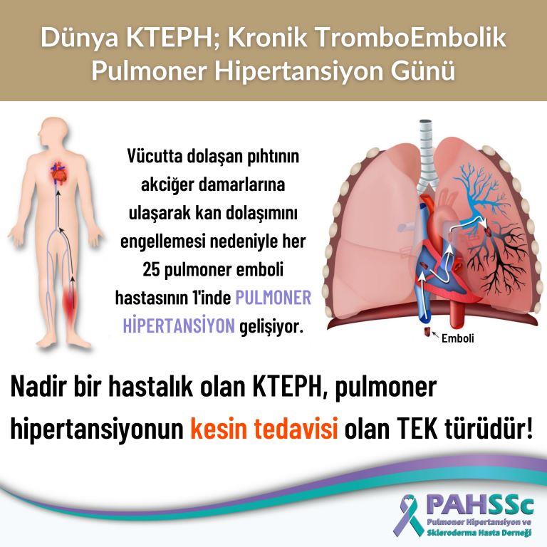 Kronik Tromboembolik Pulmoner Hipertansiyon (KTEPH) Günü